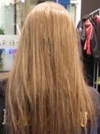 חולת טריכוטילומניה אחרי טיפול שחזור שיער ב-Haircenter