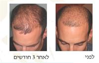 התוצאות לאחר שלושה חודשים